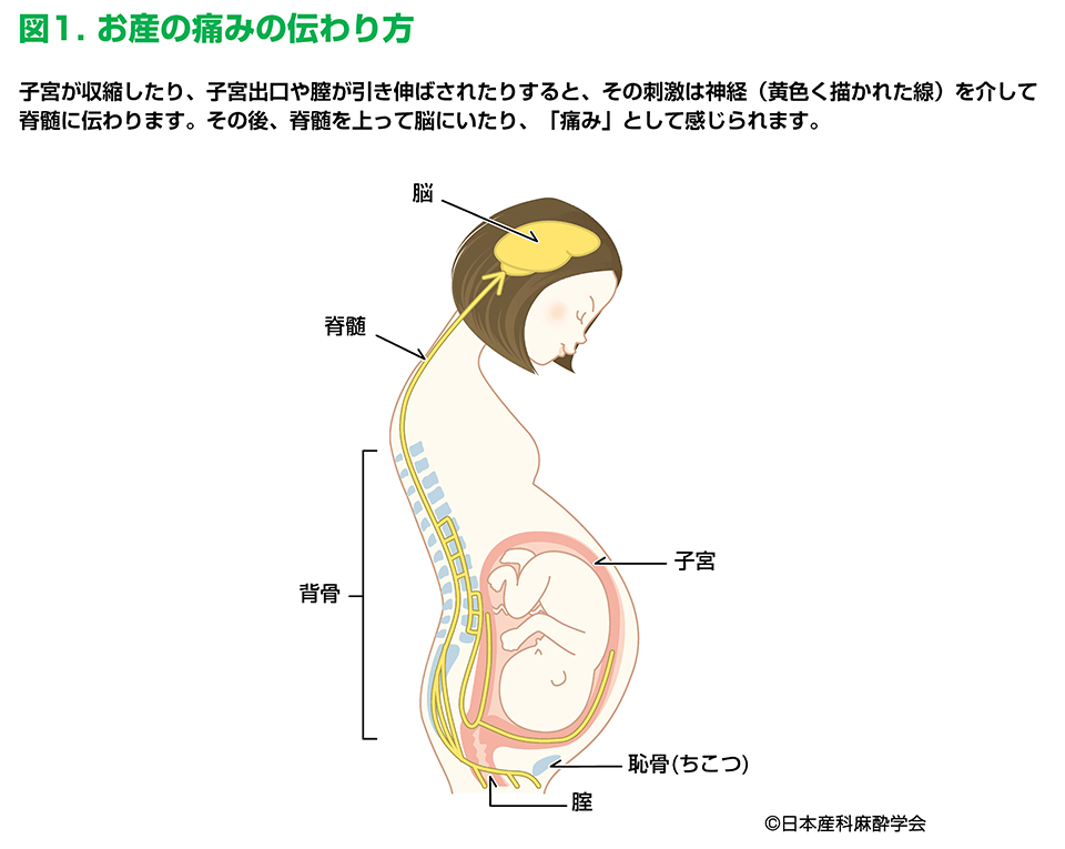 お産の痛みの伝わり方（出典日本産科麻酔学会）