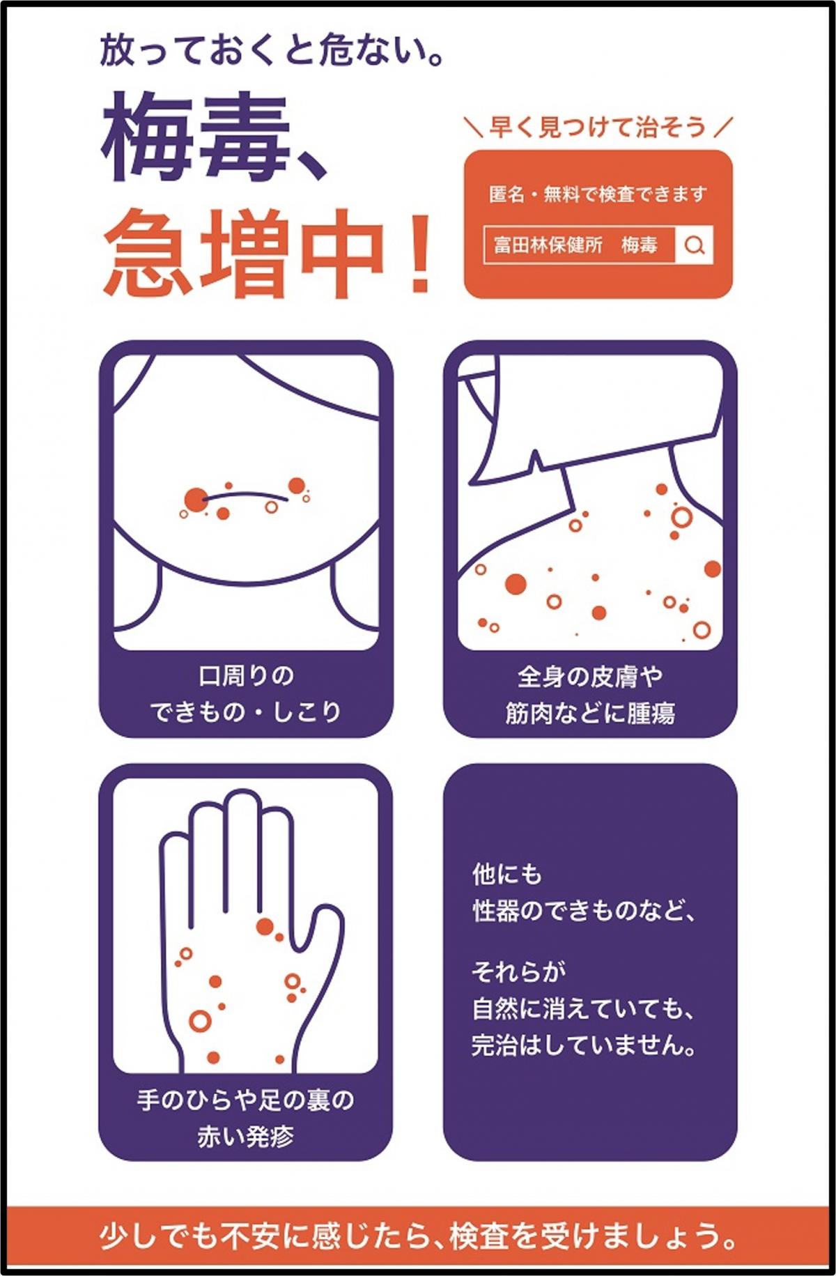 ばい