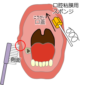 口腔状態別のケア方法の説明イラスト