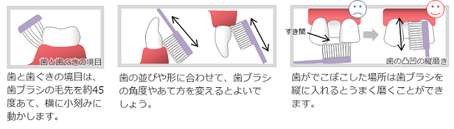 歯ブラシの当て方についての説明画像