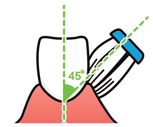 歯と歯茎の間への歯ブラシのあて方