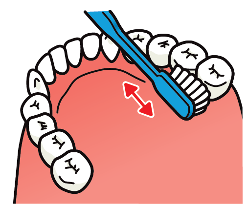 奥歯への歯ブラシのあて方