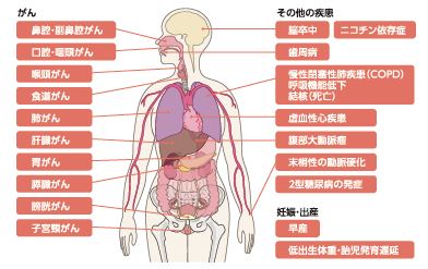 喫煙者のかかりやすい疾患